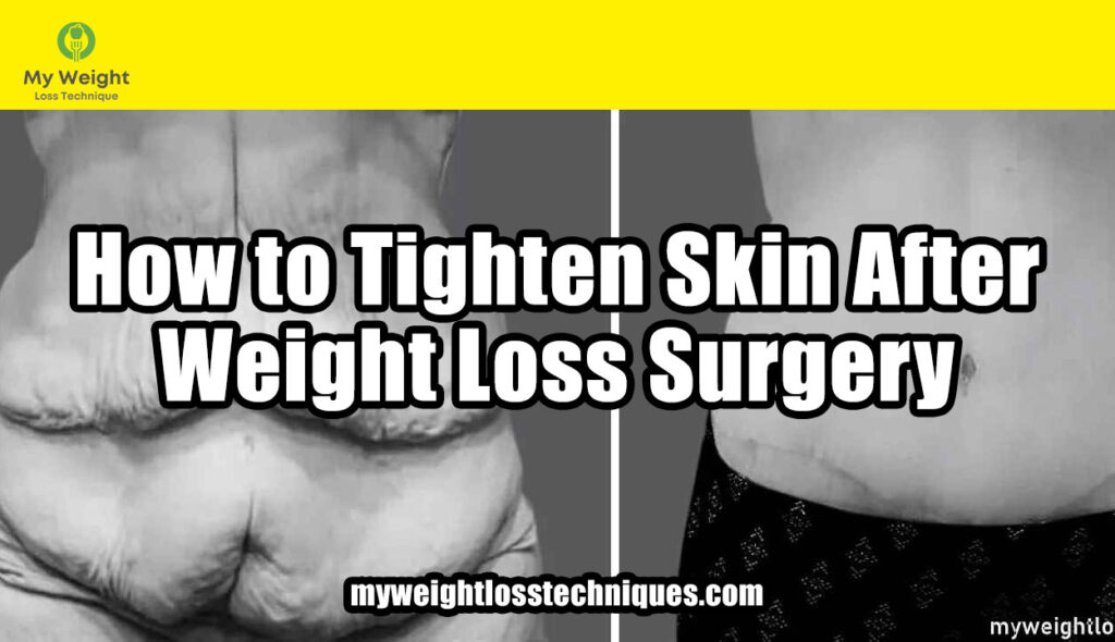 How to Tighten Skin After Weight Loss Surgery
